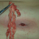 Image for article titled 10 Of The Grossest Stories You'll Ever Read